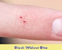 pest control for Black  Widow 53